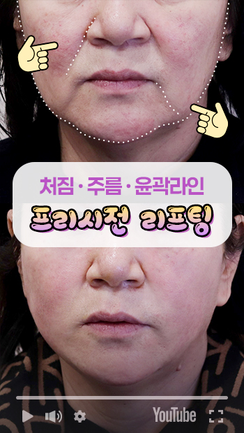 콜라겐실리프팅 썸네일