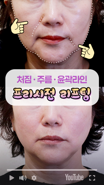 콜라겐실리프팅 썸네일