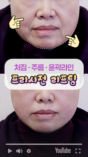 콜라겐실리프팅 썸네일