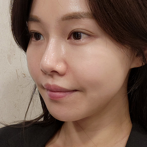 수술전